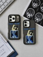 قاب X-RAY